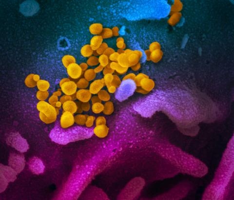 Virus that causes COVID-19 stable for hours on surfaces, study says
